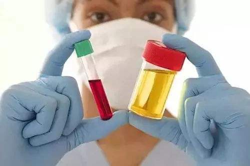 尿酸80%源自自身合成，那痛风患者还需控制食物中摄入的尿酸吗？