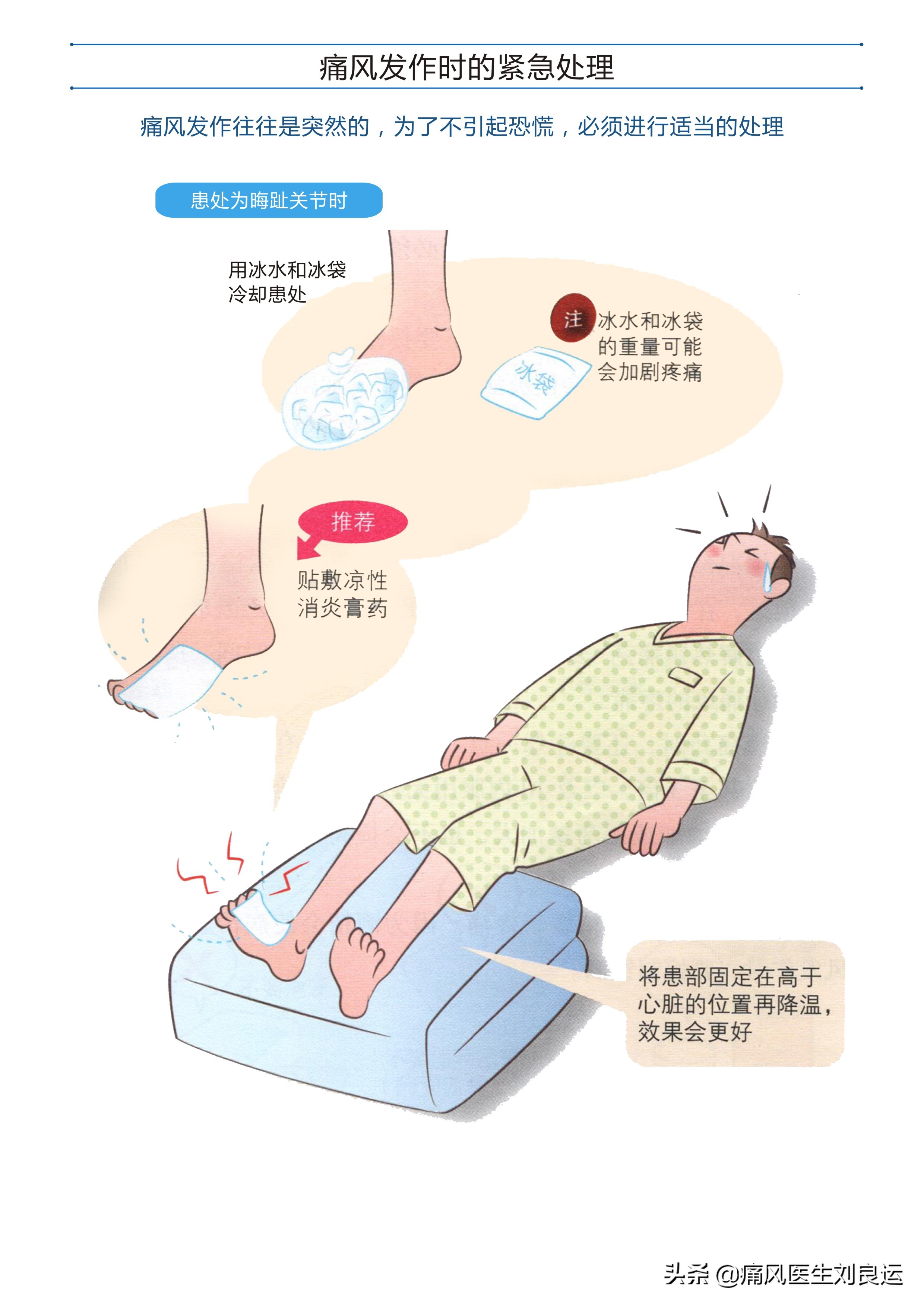 痛风时能用热敷减轻关节疼痛？医生辟谣，热敷不当可加剧疼痛