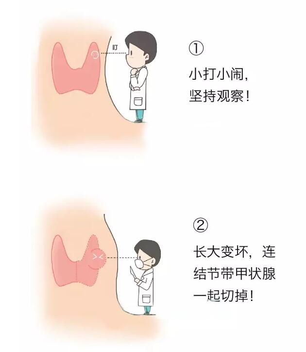 你的结节还在“观察”吗？谨慎进入误区