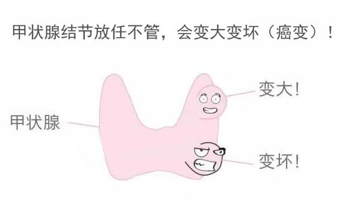 你的结节还在“观察”吗？谨慎进入误区