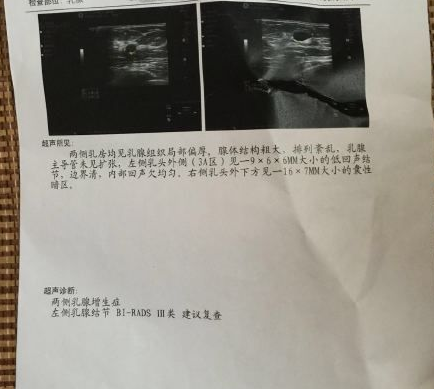 这些原因可能导致乳腺增生结节！医生：一个小方法，消肿块散结节