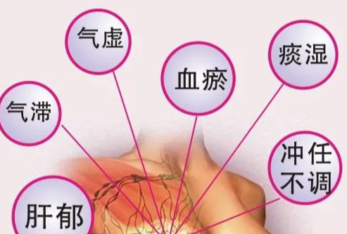 乳腺出现增生怎么调理？方法找到了，坚持下去增生可能慢慢消失