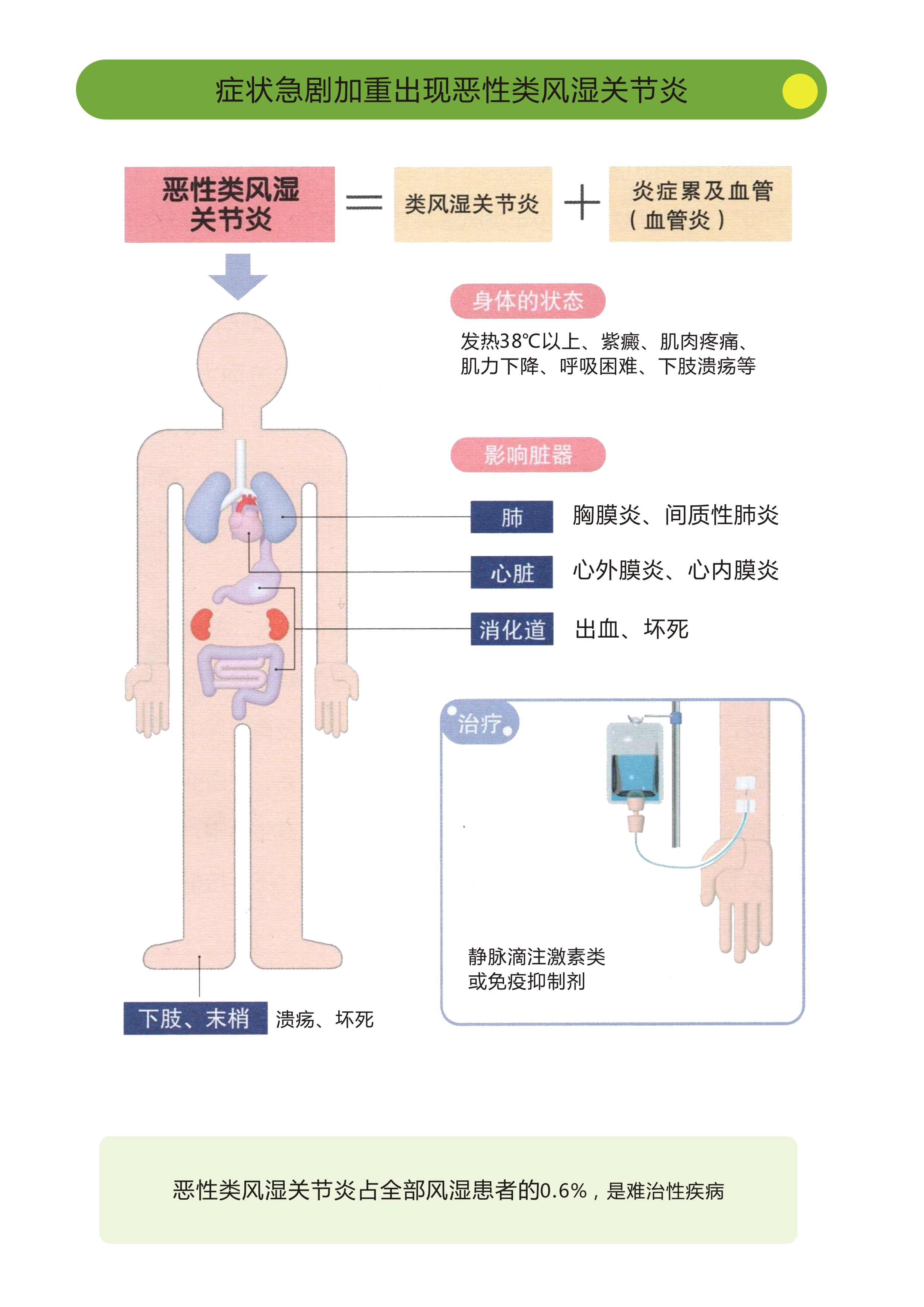 类风湿患者多久该复诊？复诊应关注哪些项目和指标？