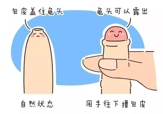 惊呆了包茎容易导致男性早泄