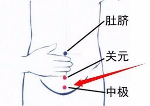 子宫腺肌症怎么调理
