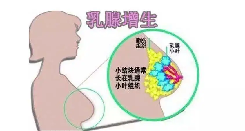 你的乳腺增生，其实都是你“养”出来的