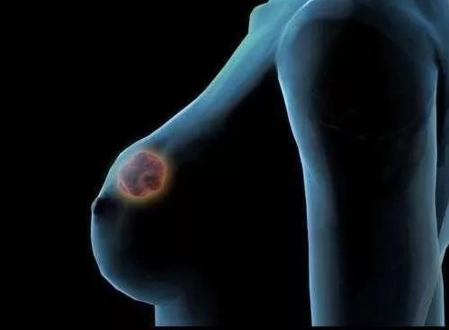 乳腺增生怎么办？这3个动作学起来事半功倍