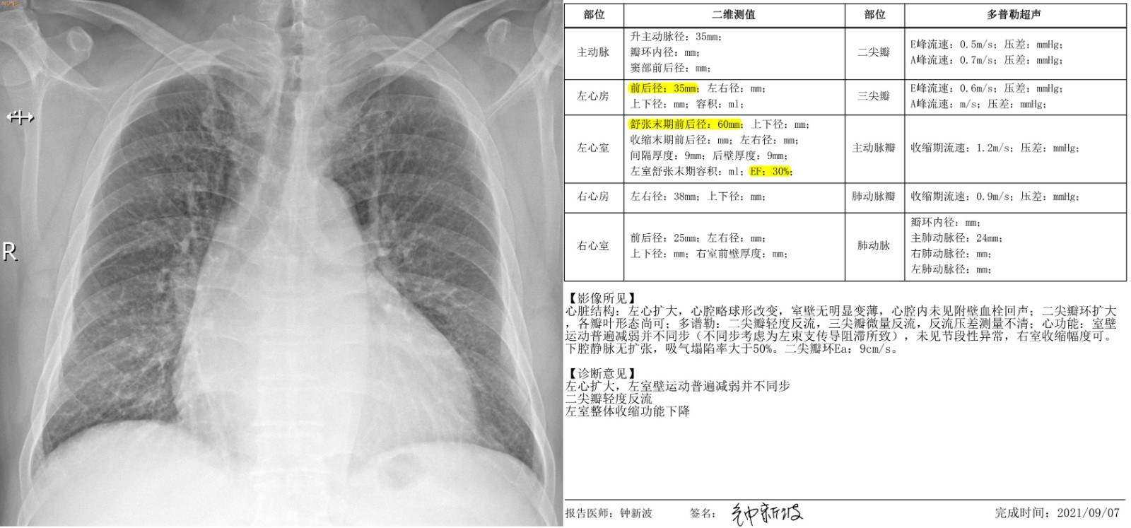 术前心脏彩超及胸片.jpg
