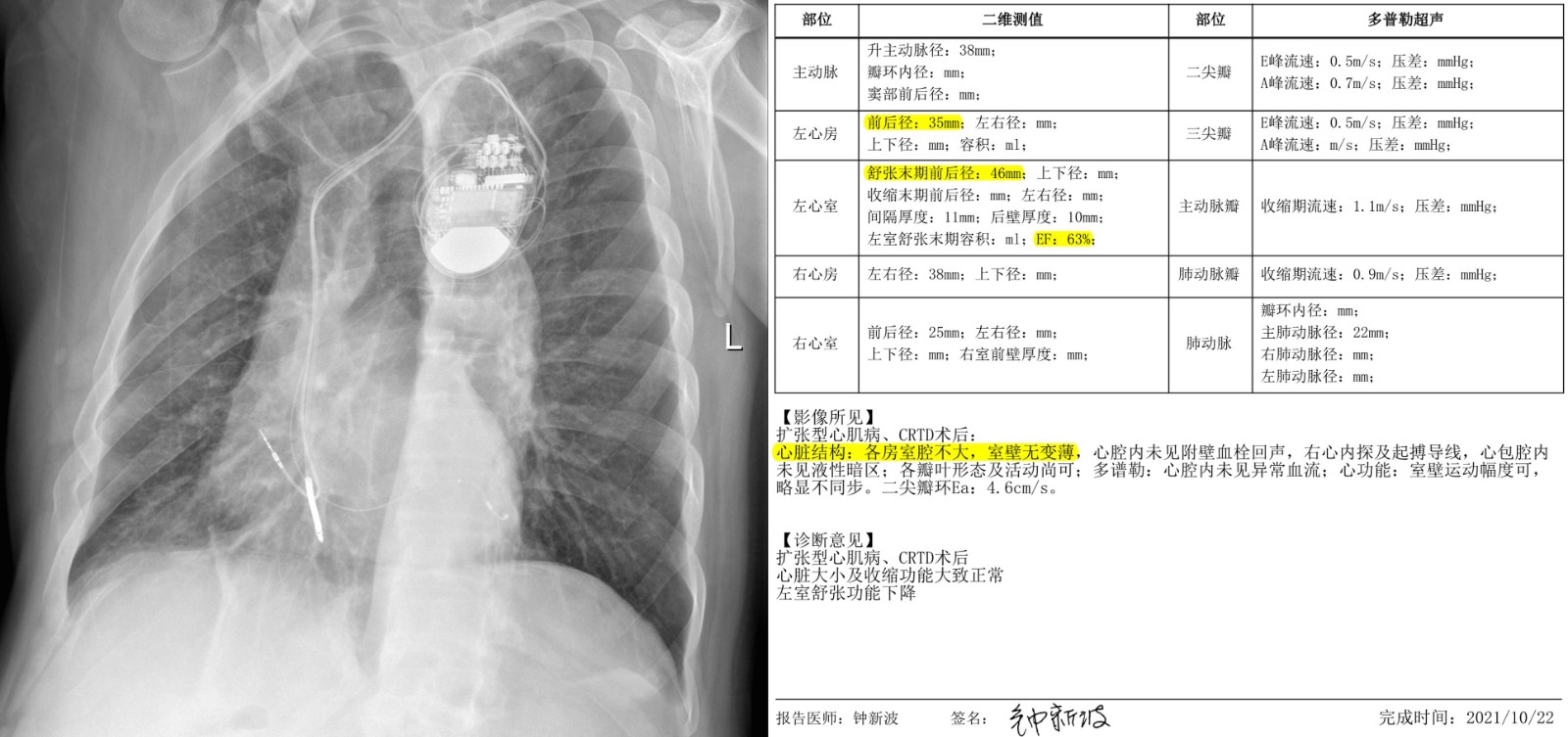 术后心脏彩超及胸片.jpg