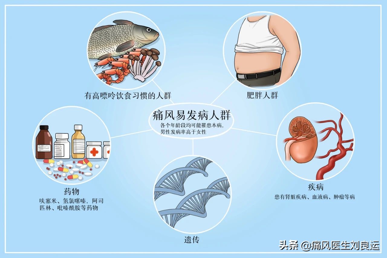 痛风发作时能忍则忍，实在痛到不能忍再吃止痛药？医生辟谣