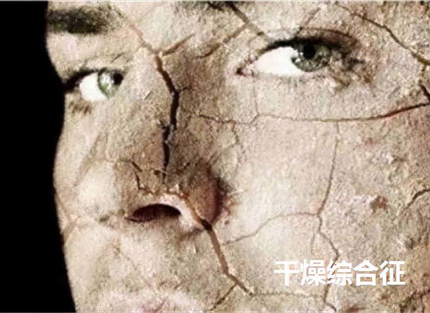 欲哭无泪、烂牙齿、慢性干咳、阴道干涩，竟都来自这种“燥证”