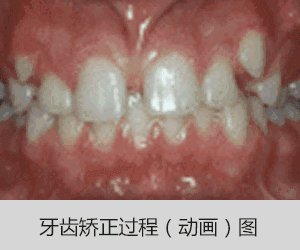 cb6b5d59e8f74401b70191d5a19c6f2c.gif