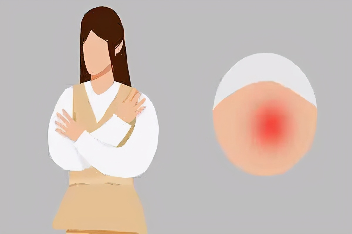 乳腺癌发病率高，若能在早期发现，生存率高，医生：抓住3个信号