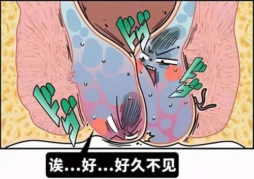 痔疮 (2).jpg