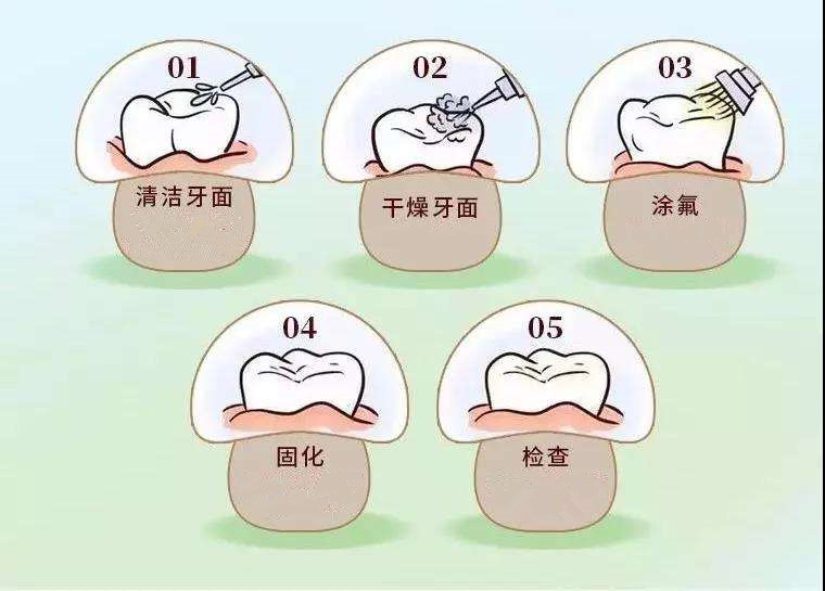 涂氟.jpg