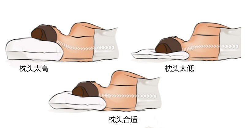 后脑勺痛，眼眶痛，担心大脑有问题？其实是枕神经痛