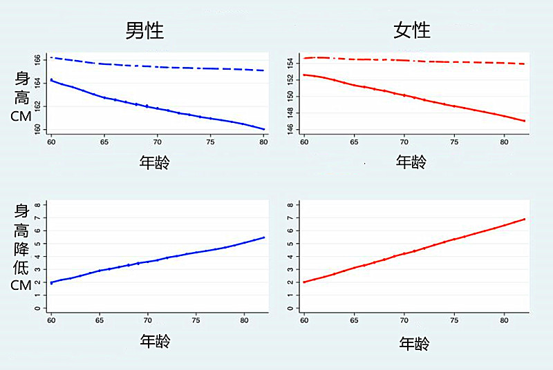 人过了40岁，每10年就会变矮0.84厘米，该怎么办？