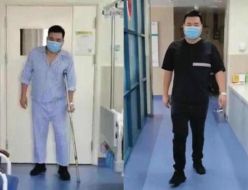 骨折复位固定就没事了吗？当心创伤性关节炎