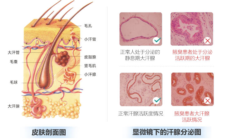 病理.png
