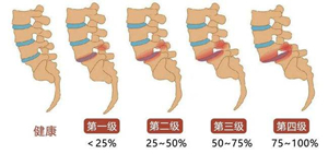 腰椎退行性疾病.jpg