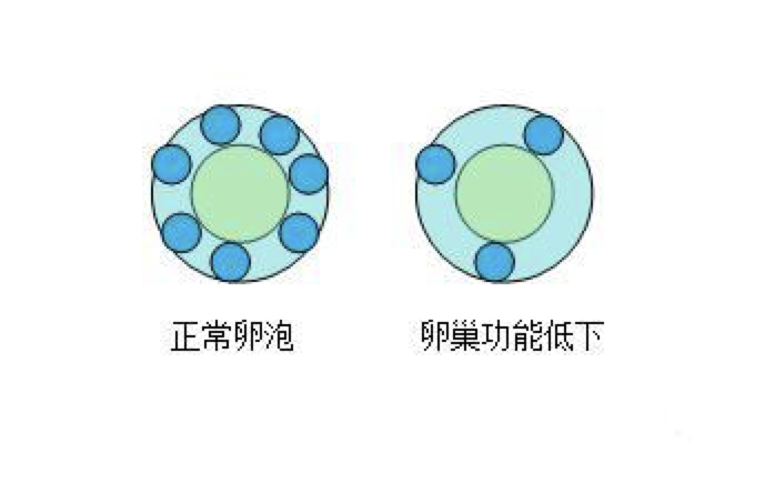 卵巢功能减退是怎么回事？