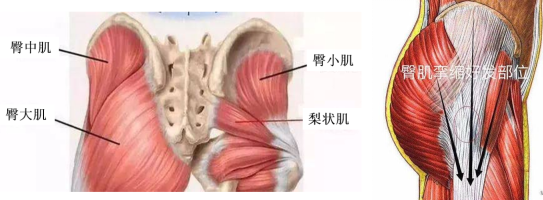 关节镜微创治疗臀肌挛缩症（弹响髋）