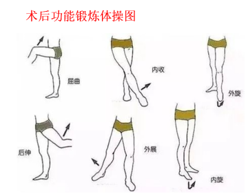 关节镜微创治疗臀肌挛缩症（弹响髋）