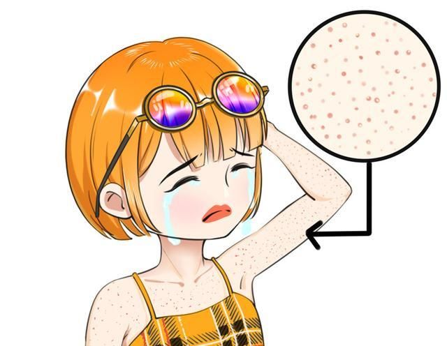 鸡皮肤1.jpg