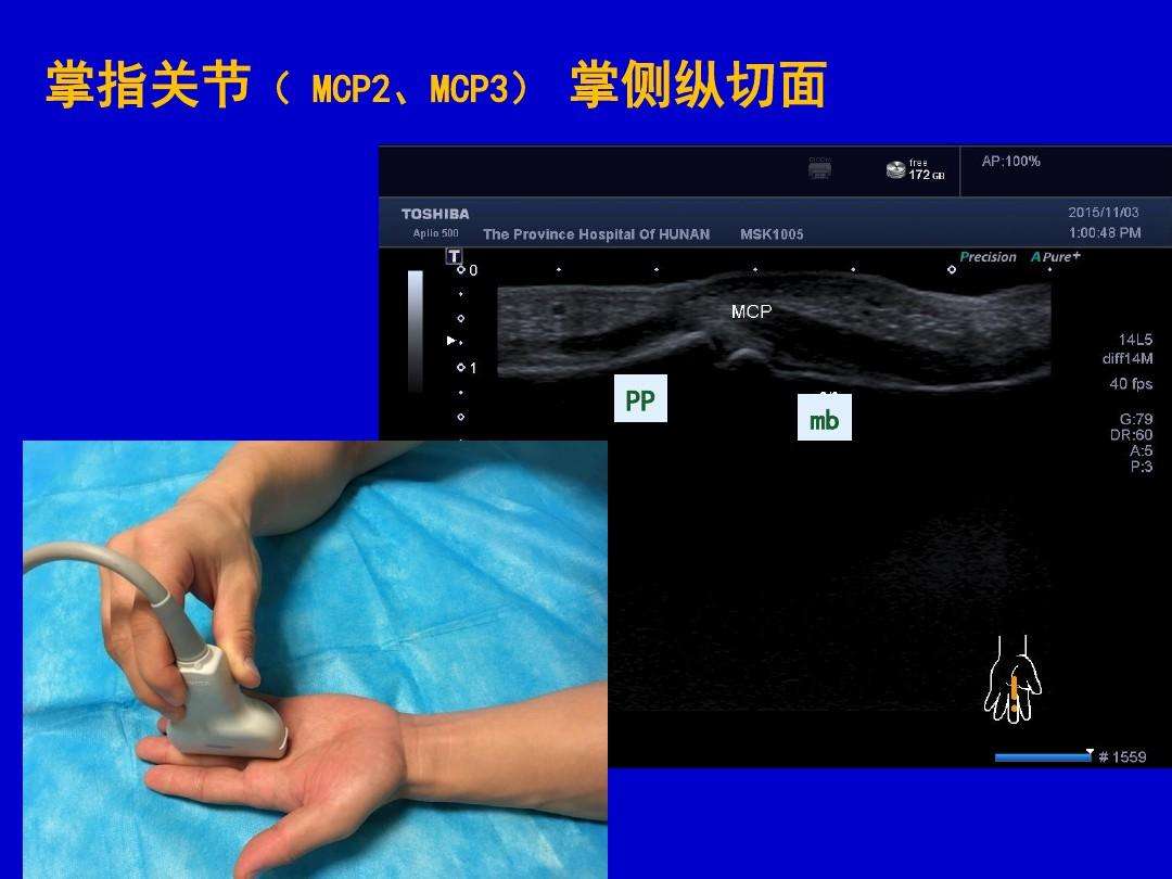 超声.jpg