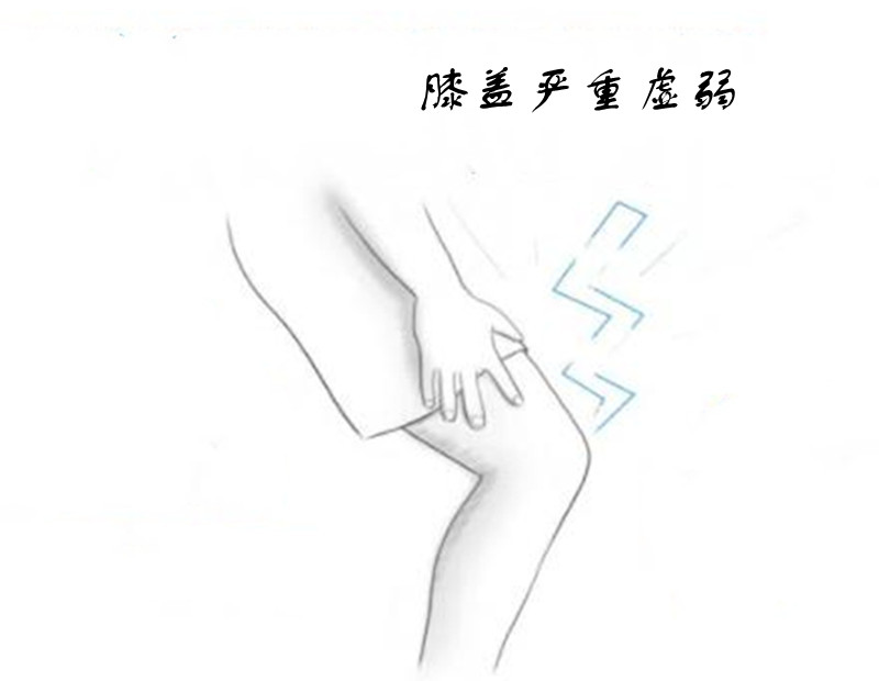 膝盖受伤不一定去医院，除非有这5种迹象
