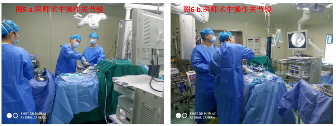 大姐膝盖一直疼，一查竟是半月板撕裂！关节微创小手术解决大问题