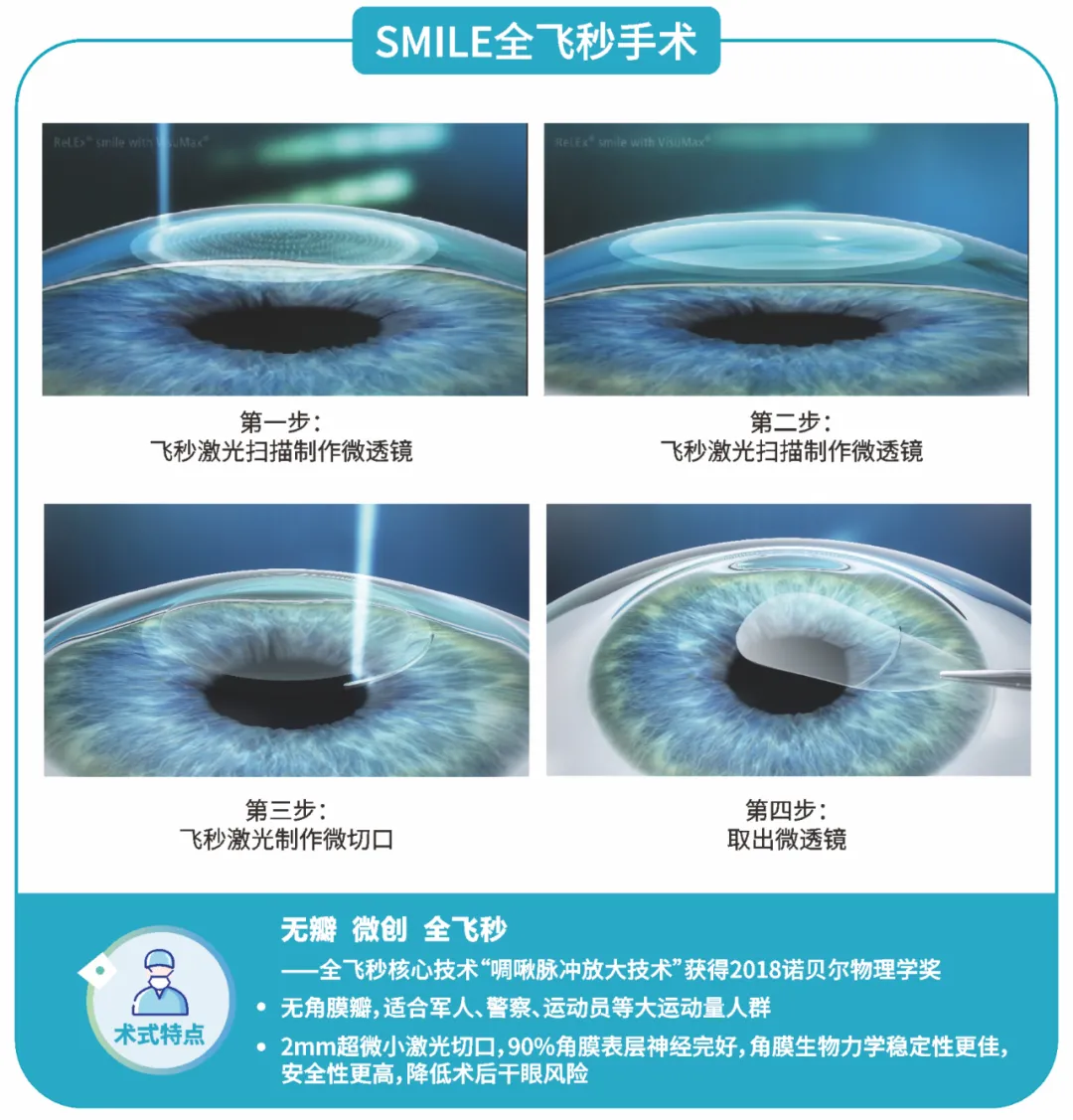 近视手术全解答3——近视手术那么多都有什么不同呢？