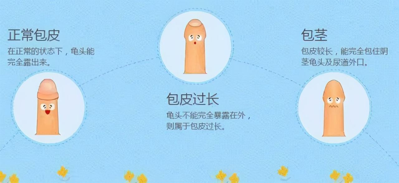 包皮手术后怎样恢复的快