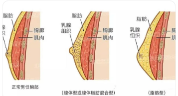 男乳1.png