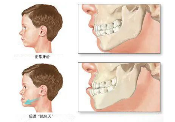 1645851606745537.png image.png