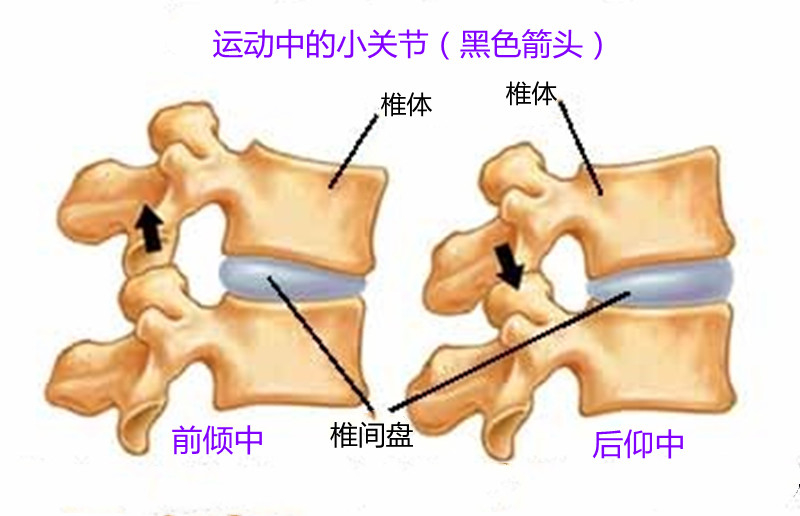 不要再搞混了，什么是椎间盘突出，腰肌劳损，小关节紊乱