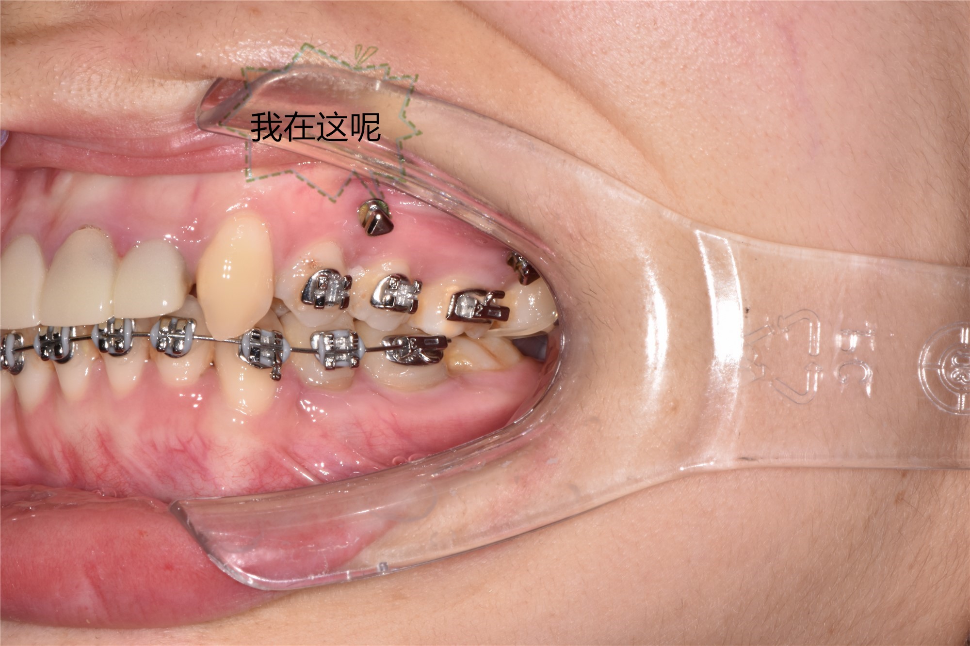 1646280173772843.jpg DSC_0497_副本_副本.jpg