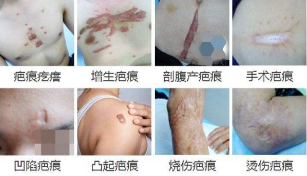 微信图片_20220319221632.png