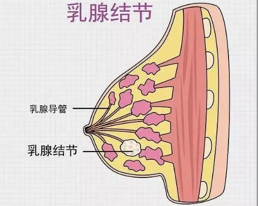 乳腺结节1.png