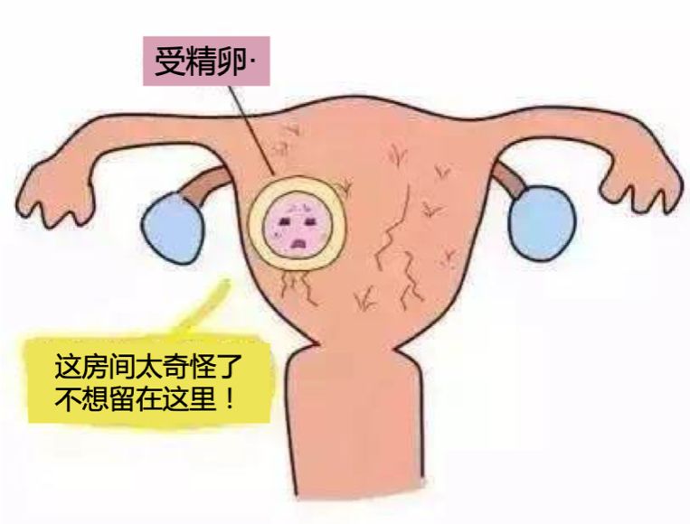 复发性流产-子宫因素1.jpeg