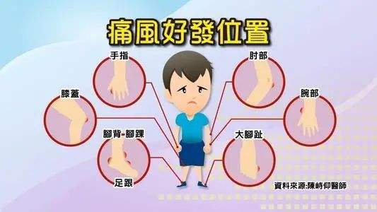 痛风好发位置.jpeg