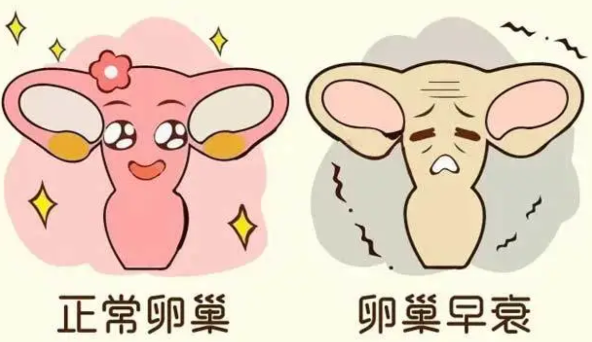 卵巢早衰.png