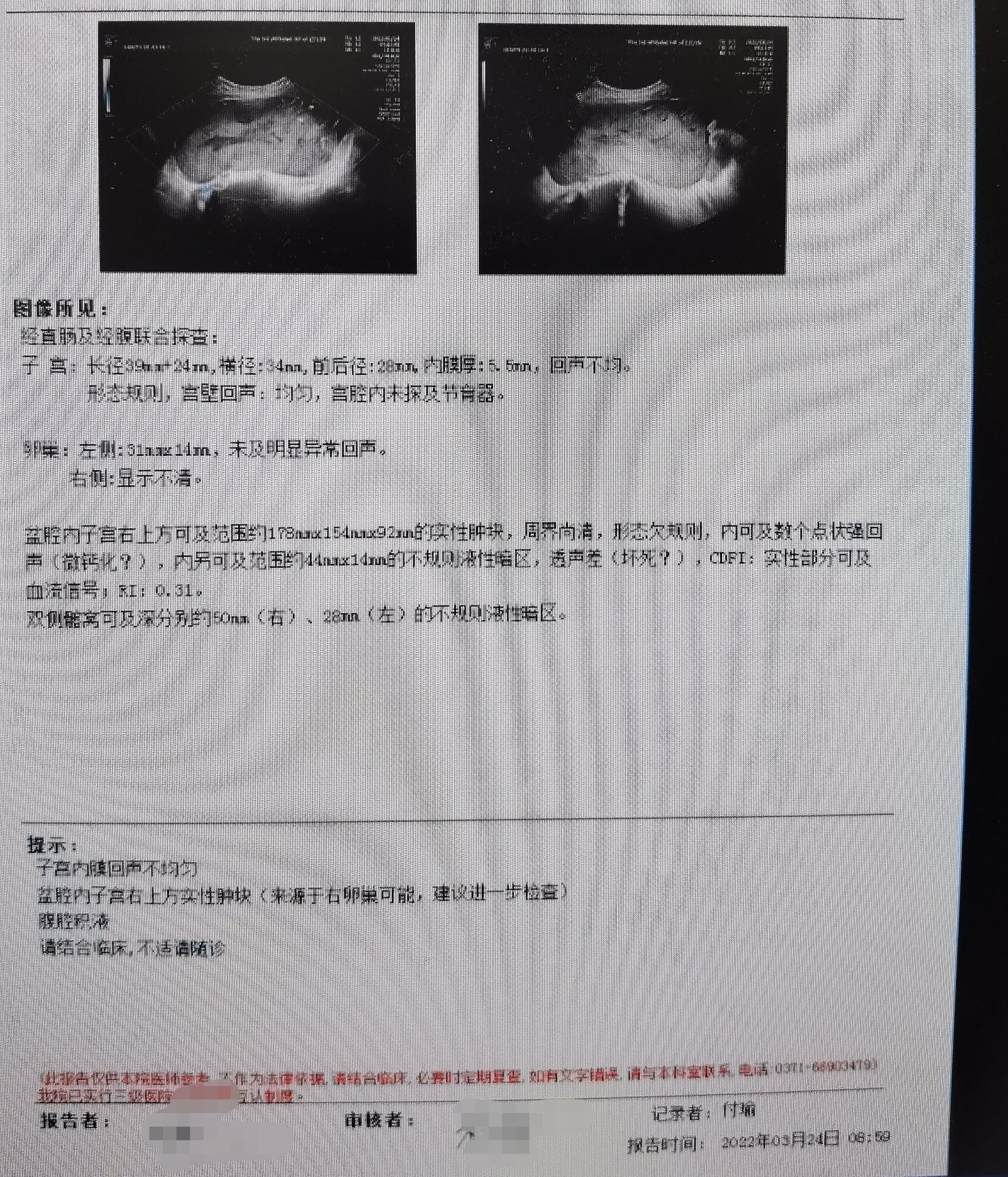 彩超.jpg