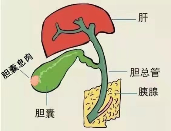 173b6be24cfdf9675fd46771eb17b41.jpg