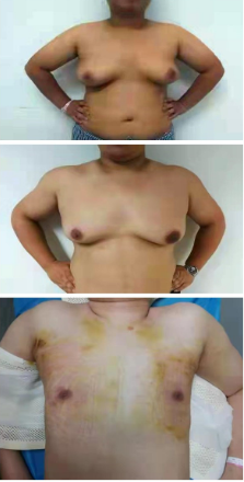 男乳3.png