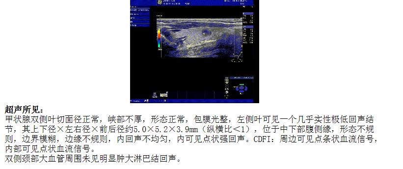 捕获 (2).JPG