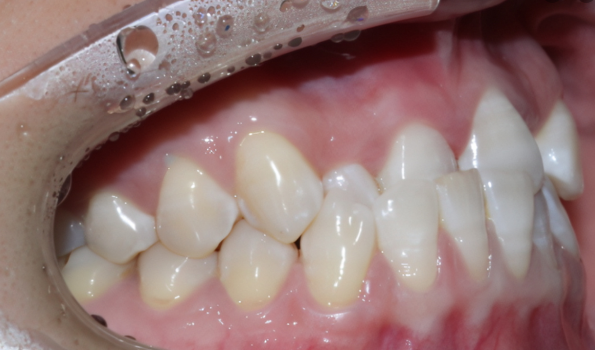 1649742874564218.png 地包天.png