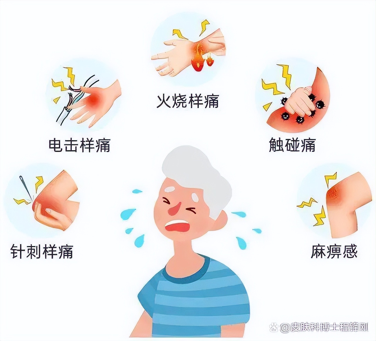 你适合打带状疱疹疫苗吗？