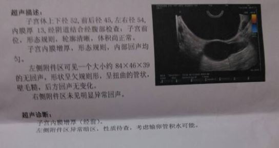 左侧输卵管积水.JPG
