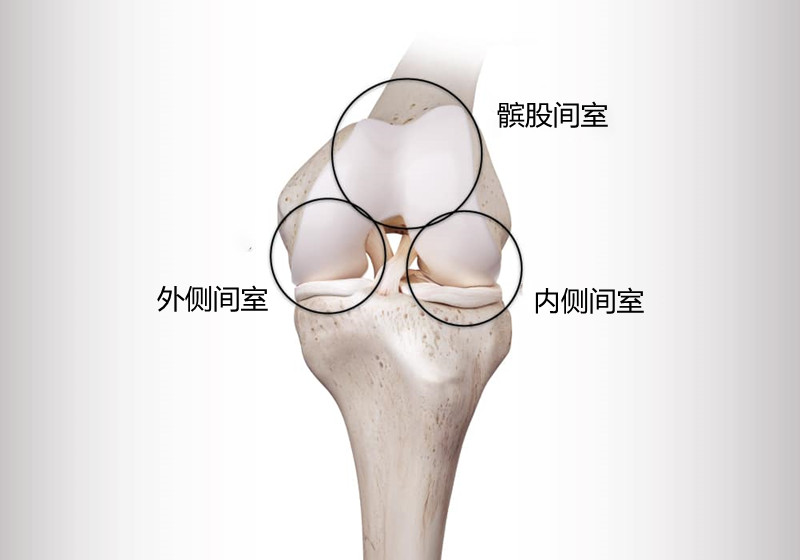 换膝盖换一半行不行，医生来讲解部分膝关节置换